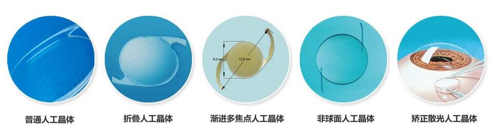 白内障手术.jpg 白内障手术.jpg