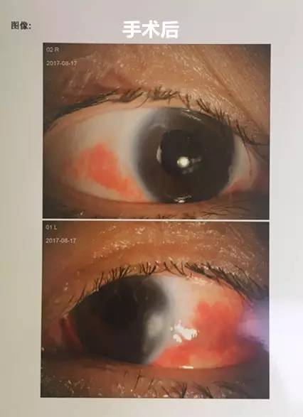 成都易游体育白内障.jpg