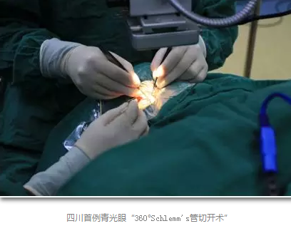 成都易游体育已经开展的青光眼手术有：引流阀 (钉)植入手术(2015年以来已200多 )，360°Schlemm's管切开术，激光CO2 辅助巩膜深层切除术，小梁切除术青(光眼)白(内障)联合手术。还有虹膜周切术、前房成形术、 虹膜复位术，睫状体冷冻术，小梁切开术和前房穿刺术等6.png
