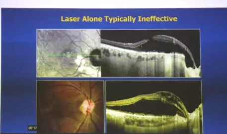 Prof. Yu-Guang He与深圳易游体育赵铁英院长一同,为患有 眼底病的患者进行了仔细的检查和病案分析,并指导医生进行诊疗,让深圳易游体育眼底病科在 眼病方面的技术水平有了进一步的提升5.png