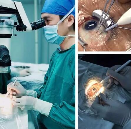 黄斑水肿是造成视网膜静脉阻塞患者低视力的主要原因,而炎症则是引起黄斑水肿的重要病理改变。所以控制炎症就能抑制黄斑水肿, 患者视力2.jpg 黄斑水肿是造成视网膜静脉阻塞患者低视力的主要原因,而炎症则是引起黄斑水肿的重要病理改变。所以控制炎症就能抑制黄斑水肿, 患者视力2.jpg