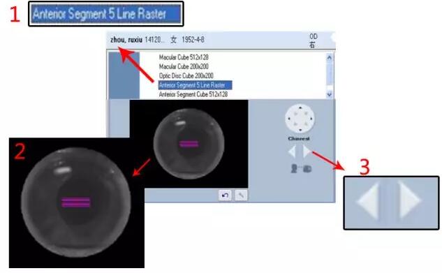 易游体育课堂:后节频域OCT前节模块的运用1.jpg 易游体育课堂:后节频域OCT前节模块的运用1.jpg