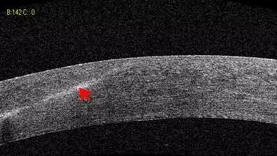 易游体育课堂:后节频域OCT前节模块的运用4.jpg 易游体育课堂:后节频域OCT前节模块的运用4.jpg