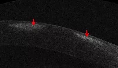 易游体育课堂:后节频域OCT前节模块的运用5.jpg 易游体育课堂:后节频域OCT前节模块的运用5.jpg