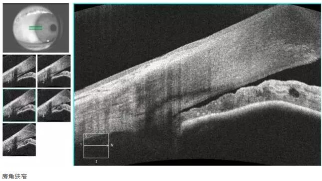 易游体育课堂:后节频域OCT前节模块的运用13.jpg 易游体育课堂:后节频域OCT前节模块的运用13.jpg