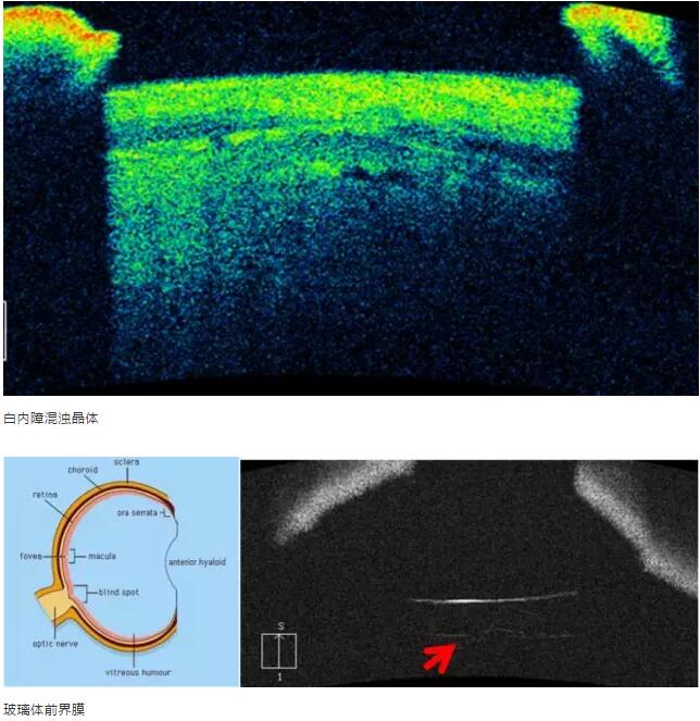 易游体育课堂:后节频域OCT前节模块的运用14.jpg 易游体育课堂:后节频域OCT前节模块的运用14.jpg