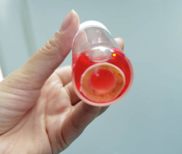 角膜移植6.png 角膜移植6.png