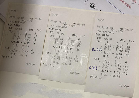 在杭州易游体育高度近视手术后，近视2550度配不到眼镜的四川大哥，看清了！2.png