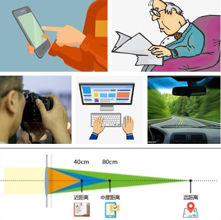 东莞易游体育为热爱摄影的双眼老年性白内障患者进行三焦点晶体植入手术1.png 东莞易游体育为热爱摄影的双眼老年性白内障患者进行三焦点晶体植入手术1.png