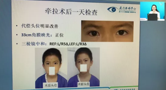 高峰论道·云端荟萃 ▏万人同步在线，30余名大咖云集“第六届易游体育论坛斜视与小儿眼科新技术学习班暨小儿、眼视光分论坛”7.png