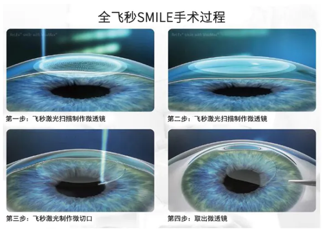 2021年征兵时间已定,参加征兵近视青年需尽快做近视手术1.png 2021年征兵时间已定,参加征兵近视青年需尽快做近视手术1.png