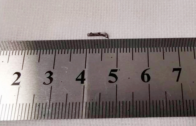 易游体育徐州复兴眼科王海菊:妙手拨迷障,匠心护光明3.png 易游体育徐州复兴眼科王海菊:妙手拨迷障,匠心护光明3.png